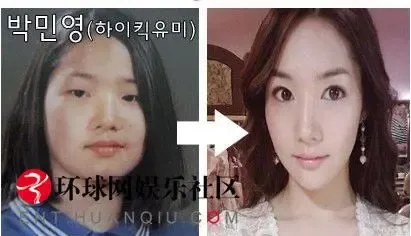 <em>城市猎人</em>》<em>女主角</em>金娜娜朴敏英整容全过程(组