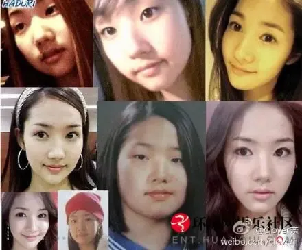 城市猎人》<em>女主角</em>金娜娜朴敏英整容全过程(组