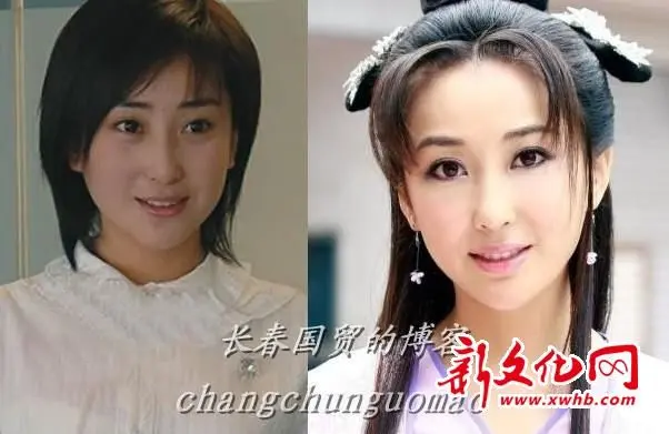 严宽女友杜晓婷整容前照片曝光 丑女变天仙-碧