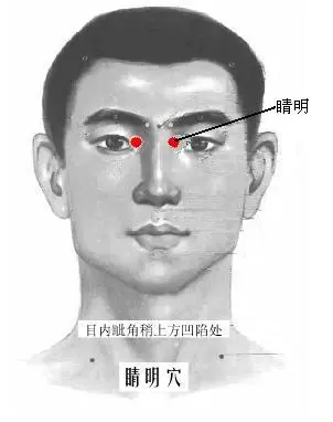 睛明穴1
