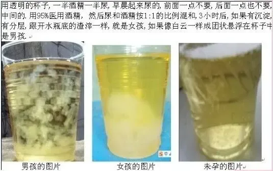 自我检测<em>怀孕是男是女</em>?