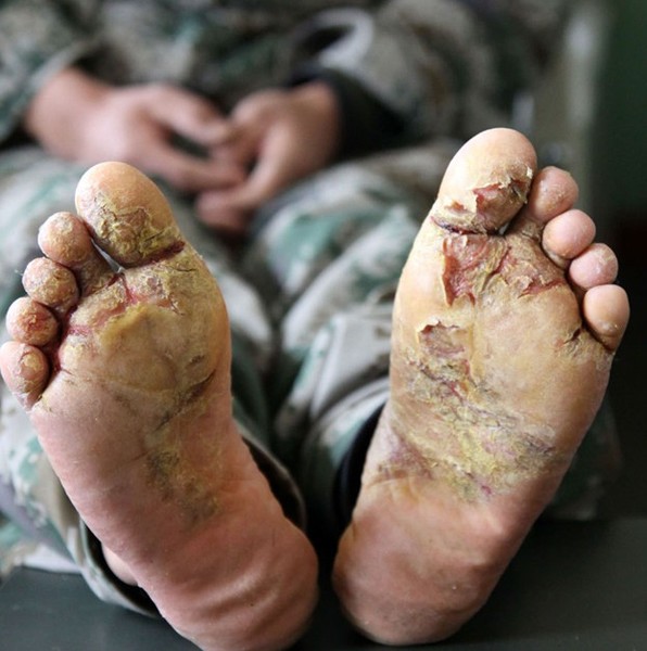 偶然看到一张照片——一双行走在阿里雪山的巡逻队军人的脚,乍一看